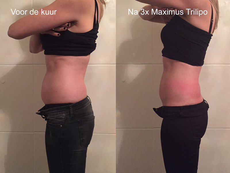 HappyShape voorna zij klein